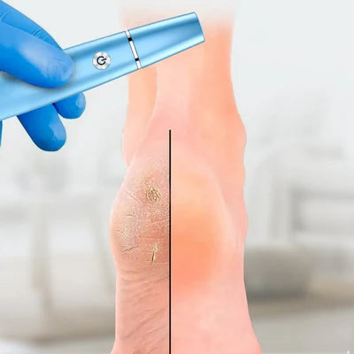 🔥2026 HOT SALE💥Rechargeable Electric Foot File – Smooth Heels, Anytime Anywhere