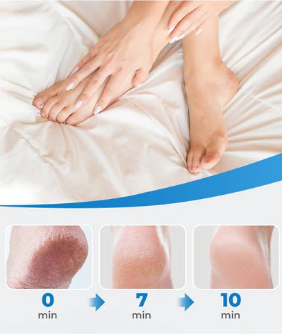 🔥2026 HOT SALE💥Rechargeable Electric Foot File – Smooth Heels, Anytime Anywhere