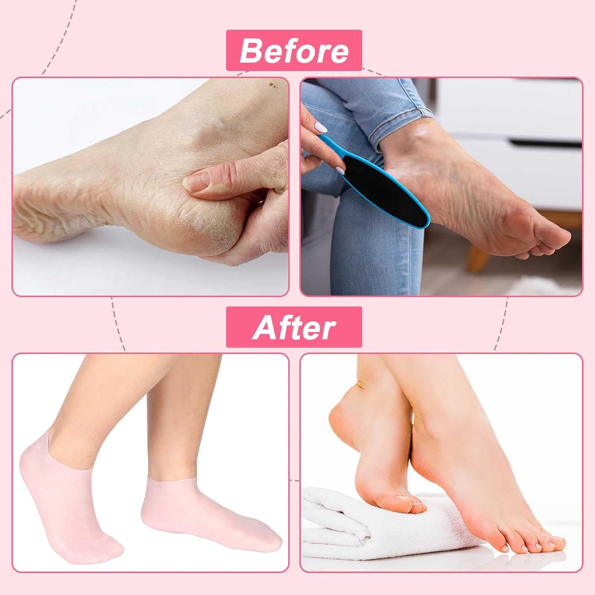 🥳Buy 1 Free 1🦶✨ Moisturizing Foot Mask Socks Silicone Gel Moisturizing Socks