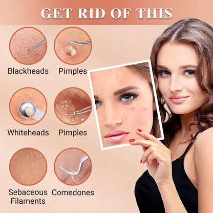 💓💥Blackhead Remover Pimple Extractor Tool Kit
