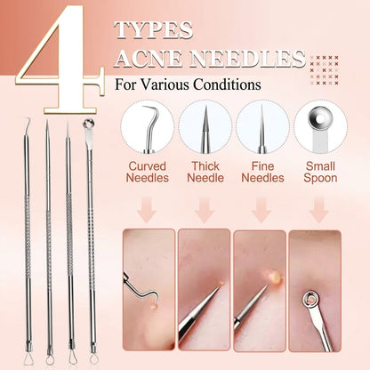 💓💥Blackhead Remover Pimple Extractor Tool Kit