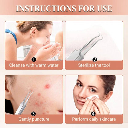 💓💥Blackhead Remover Pimple Extractor Tool Kit