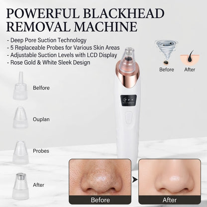 ✨HOT SALE✨Powerful Blackhead Removal Machine – Skin Care & Pore Cleaner