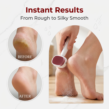 ✨📢LAST DAY SALE🔥Double-Sided Foot Scraper for Callus Removal Double-sided Pedicure Knife