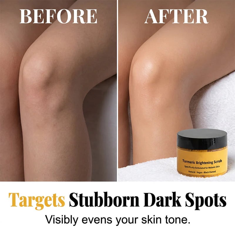 🔥BUY 3 GET 2 FREE🔥Turmeric Exfoliating Body Scrub