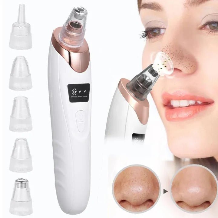 ✨HOT SALE✨Powerful Blackhead Removal Machine – Skin Care & Pore Cleaner