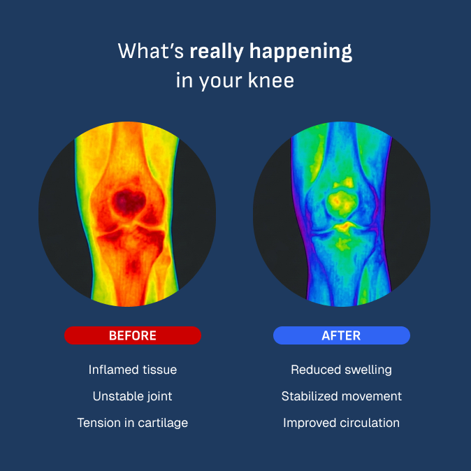 ✨50% Off For A Limited Time✨5-in-1 Adjustable Smart Knee Brace