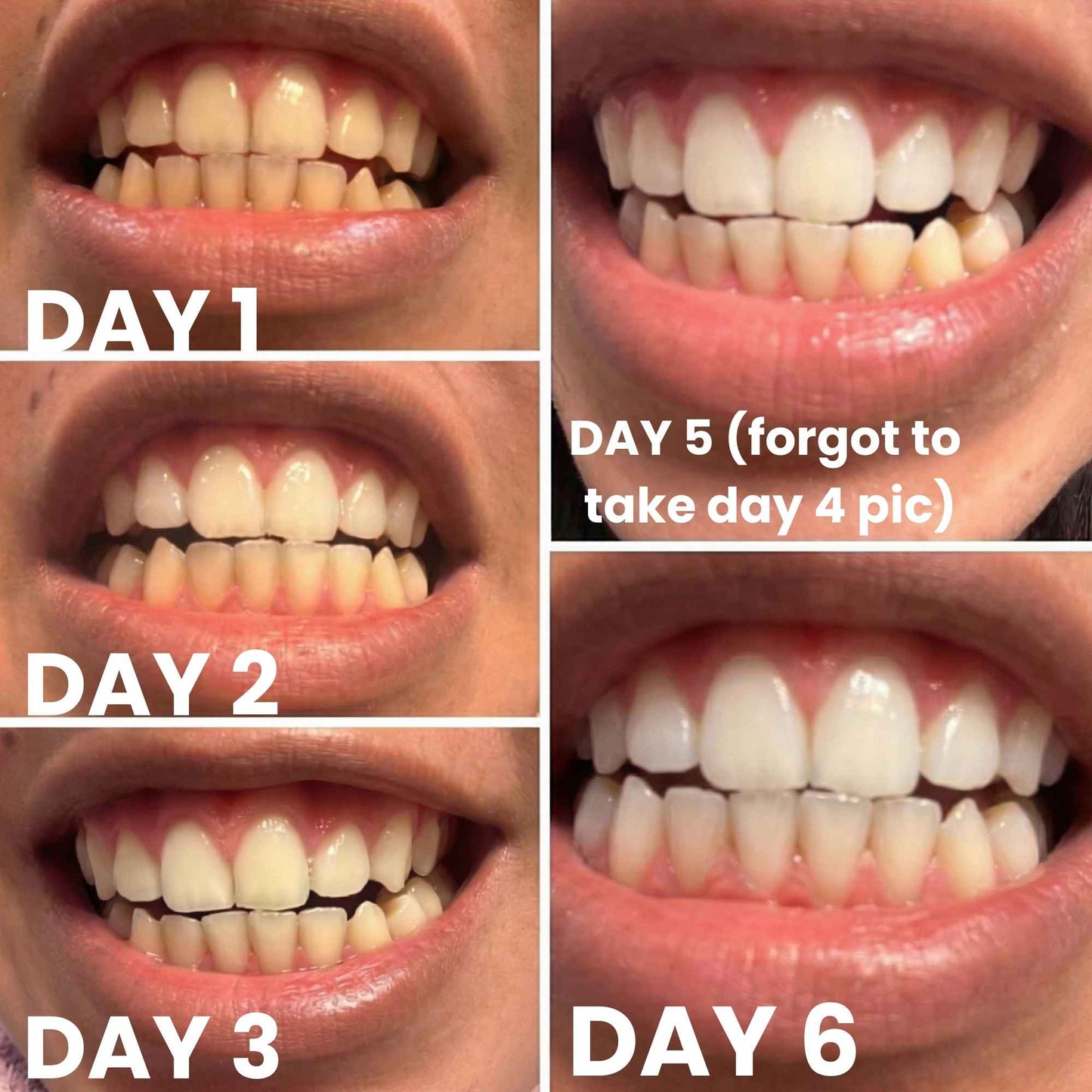 Teeth Whitening Strips Kit | PortableDental Whitening Strips | ReducedSensitivity White Strips for Home Use
