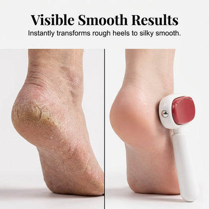 ✨📢LAST DAY SALE🔥Double-Sided Foot Scraper for Callus Removal Double-sided Pedicure Knife