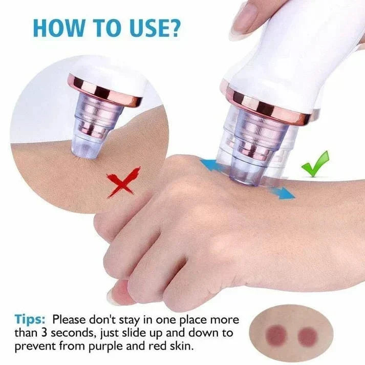 ✨HOT SALE✨Powerful Blackhead Removal Machine – Skin Care & Pore Cleaner